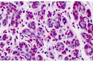 Human Breast: Formalin-Fixed, Paraffin-Embedded (FFPE) (Bcl-2 Antikörper  (FITC))