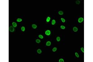 Immunofluorescence staining of A549 cells with ABIN7127548 at 1:43. (Rekombinanter HNRNPK Antikörper)