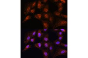 Immunofluorescence analysis of C6 cells using BCL3 Rabbit pAb (ABIN6134239, ABIN6137509, ABIN6137510 and ABIN7101379) at dilution of 1:100. (BCL3 Antikörper  (AA 300-400))