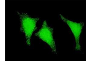 Immunofluorescence of monoclonal antibody to STAU1 on HeLa cell. (STAU1/Staufen Antikörper  (AA 401-496))