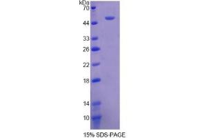 SDS-PAGE of Protein Standard from the Kit (Highly purified E. (Fibrinogen beta Chain ELISA Kit)
