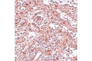Immunohistochemical staining of human spleen tissue with LIN28 polyclonal antibody  at 5 ug/mL dilution.