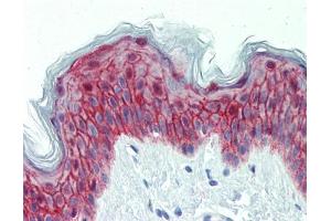 IHC-P Image Immunohistochemical analysis of paraffin-embedded human skin, using Galanin Receptor 2, antibody(10 μg/ml). (GALR2 Antikörper  (C-Term))