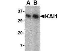 Western Blotting (WB) image for anti-CD82 (CD82) (C-Term) antibody (ABIN2472638) (CD82 Antikörper  (C-Term))