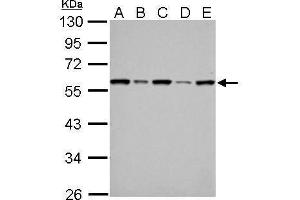 WB Image FKBP4 antibody detects FKBP4 protein by Western blot analysis. (FKBP4 Antikörper  (Center))