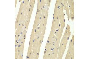 Immunohistochemistry (IHC) image for anti-Ubiquitin Specific Peptidase 7 (Herpes Virus-Associated) (USP7) (AA 206-1102) antibody (ABIN6150031)