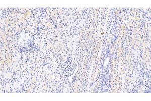 Detection of PARP4 in Human Kidney Tissue using Polyclonal Antibody to Poly ADP Ribose Polymerase 4 (PARP4)