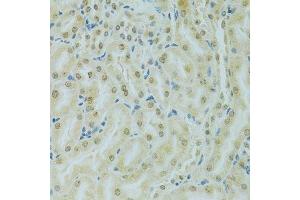 Immunohistochemistry of paraffin-embedded mouse kidney using RCC1 antibody. (RCC1 Antikörper  (AA 1-240))