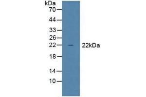 Detection of GPX1 in Mouse Liver Tissue using Polyclonal Antibody to Glutathione Peroxidase 1 (GPX1) (Glutathione Peroxidase 1 Antikörper  (AA 50-203))