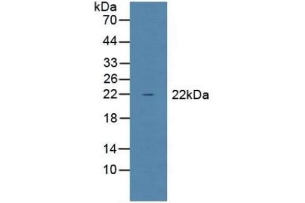 Glutathione Peroxidase 1 Antikörper  (AA 50-203)