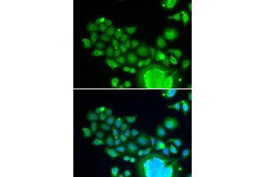 Immunofluorescence analysis of HeLa cells using FZR1 antibody (ABIN6130399, ABIN6140852, ABIN6140854 and ABIN6221196). (FZR1 Antikörper  (AA 224-493))