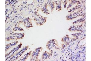 Formalin-fixed and paraffin embedded rat lung labeled with Anti- Preproendothelin 1 Polyclonal Antibody, Unconjugated  at 1:200 followed by conjugation to the secondary antibody and DAB staining (Prepro-Endothelin-1 (AA 16-110) Antikörper)