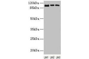 Western blot All lanes: ZNF546 antibody at 4 μg/mL Lane 1: A549 whole cell lysate Lane 2: 293T whole cell lysate Lane 3: Hela whole cell lysate Secondary Goat polyclonal to rabbit IgG at 1/10000 dilution Predicted band size: 99 kDa Observed band size: 99 kDa (ZNF546 Antikörper  (AA 1-300))