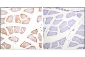 Immunohistochemistry analysis of paraffin-embedded human skeletal muscle tissue, using Akt (Ab-129) Antibody. (AKT1 Antikörper  (AA 95-144))