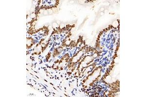 Immunohistochemistry analysis of paraffin-embedded mouse ileum using HNRNPM (ABIN7074247) at dilution of 1: 4000 (HnRNP M1-M4 Antikörper)