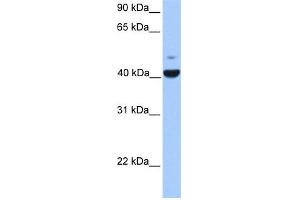 WB Suggested Anti-FGFR1OP Antibody Titration: 0. (FGFR1OP Antikörper  (N-Term))