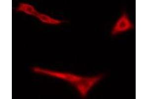 ABIN6275076 staining Hela cells by IF/ICC. (POLR3H Antikörper  (C-Term))