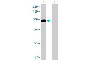 Western Blotting (WB) image for NPAS2 293T Cell Transient Overexpression Lysate(Denatured) (ABIN1332789)
