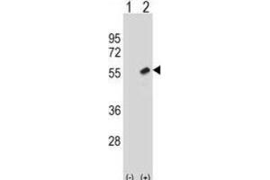 Western Blotting (WB) image for anti-Retinoblastoma Binding Protein 7 (RBBP7) antibody (ABIN2998665) (RBBP7 Antikörper)