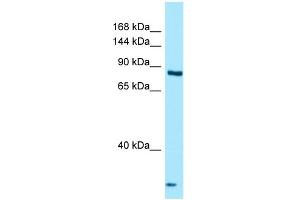 Western Blotting (WB) image for anti-Thyroid adenoma-associated protein (THADA) (C-Term) antibody (ABIN2789989) (THADA Antikörper  (C-Term))