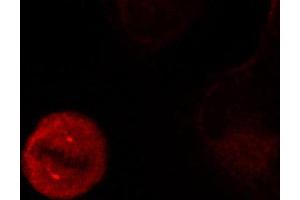 Immunofluorescence staining of methanol-fixed Hela cells showing centrosome and nuclear staining using Phospho-MAPK3-Y204 antibody. (ERK1 Antikörper  (pTyr204))