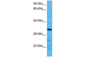 Host:  Mouse  Target Name:  MBD3  Sample Tissue:  Mouse Brain  Antibody Dilution:  1ug/ml (MBD3 Antikörper  (N-Term))