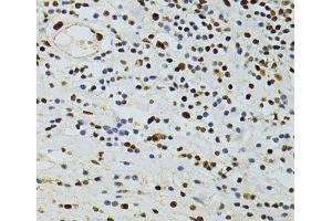 Immunohistochemistry (Paraffin-embedded Sections) (IHC (p)) image for anti-THO Complex 4 (THOC4) antibody (ABIN7261904)