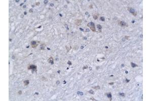 Formalin-fixed and paraffin embedded rat brain tissue labeled with Anti-Bak Polyclonal Antibody, Unconjugated (ABIN674409) followed by conjugation to the secondary antibody and DAB staining (BAK1 Antikörper  (AA 21-120))