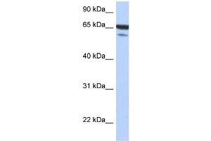 WB Suggested Anti-MAP3K7IP1 Antibody Titration: 0. (TAB1 Antikörper  (N-Term))