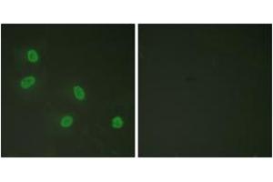 Immunofluorescence analysis of HeLa cells, using PPAR-BP (Phospho-Thr1457) Antibody. (PPAR-BP (AA 1423-1472), (pThr1457) Antikörper)