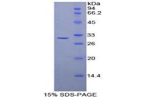 SDS-PAGE analysis of Mouse Transaldolase Protein. (TALDO1 Protein)