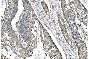 IHC analysis of IMPDH1 using anti-IMPDH1 antibody (ABIN7599864). (IMPDH1 Antikörper  (AA 123-500))