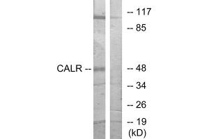 Western blot analysis of extracts from COS-7 cells, using CALR antibody. (Calreticulin Antikörper  (N-Term))