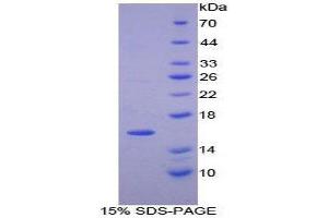 SDS-PAGE (SDS) image for PDGF-AA Homodimer (AA 94-194) protein (His tag) (ABIN1880055) (PDGF-AA Homodimer (AA 94-194) protein (His tag))