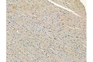 ABIN6258170 and ABIN6273862 at 1/100 staining rat heart tissue by IHC-P. (GPR22 Antikörper  (N-Term))
