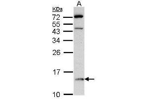 Western Blotting (WB) image for anti-D-Dopachrome Tautomerase (DDT) antibody (ABIN2855172)