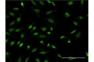 Immunofluorescence of monoclonal antibody to TBL1XR1 on HeLa cell. (TBL1XR1 Antikörper  (AA 81-178))