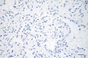 anti-GATA Zinc Finger Domain Containing 2A (GATAD2A) antibody