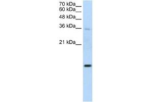 UBE2D2 antibody used at 1. (UBE2D2 Antikörper)
