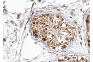 ABIN6267694 at 1/100 staining human testis tissue sections by IHC-P. (HDAC6 Antikörper  (pSer22))