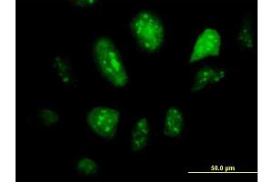 Immunofluorescence of monoclonal antibody to GCM1 on HeLa cell. (GCM1 Antikörper  (AA 108-166))