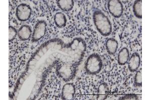 Immunoperoxidase of monoclonal antibody to ZNF138 on formalin-fixed paraffin-embedded human small Intestine. (ZNF138 Antikörper  (AA 151-251))