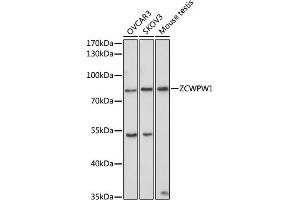 Western blot analysis of extracts of various cell lines, using ZCWPW1 antibody (ABIN6133087, ABIN6150412, ABIN6150413 and ABIN6223508) at 1:1000 dilution. (ZCWPW1 Antikörper  (AA 389-648))