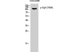 Western Blotting (WB) image for anti-Kinesin Family Member 11 (KIF11) (pThr926) antibody (ABIN5961163) (KIF11 Antikörper  (pThr926))