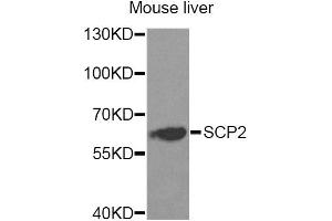 Western blot analysis of extracts of mouse liver, using SCP2 Antibody. (SCP2 Antikörper)