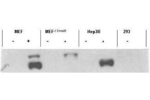 Western blot using  affinity purified anti-Smad3 pS423 pS425 antibody shows detection of endogenous Smad3 in stimulated cell lysates. (SMAD3 Antikörper  (pSer423, pSer425))