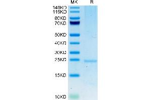 Human FGF-7/KGF on Tris-Bis PAGE under reduced condition. (FGF7 Protein (AA 32-194) (His tag))