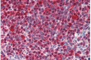 Human Spleen (formalin-fixed, paraffin-embedded) stained with HSPA8 antibody ABIN462103 at 10 ug/ml followed by biotinylated secondary antibody, alkaline phosphatase-streptavidin and chromogen. (Hsc70 Antikörper)