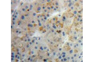 Used in DAB staining on fromalin fixed paraffin-embedded Liver tissue (LALBA Antikörper  (AA 12-142))
