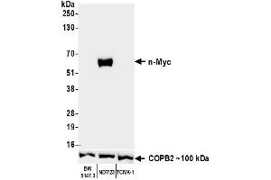 Western Blotting (WB) image for anti-N-Myc Proto-Oncogene Protein (MYCN) (AA 100-150) antibody (ABIN7795786)